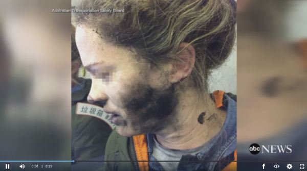 Woman-Burned-by-Headphones-on-Flight_video