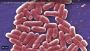 E. coli infections facts you can't unlearn about them_video