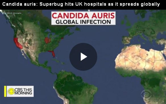Superbug hits UK hospitals as it spreads globally_video